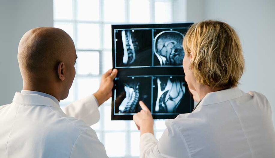 Diagnostic de l'ostéochondrose cervicale à travers des images
