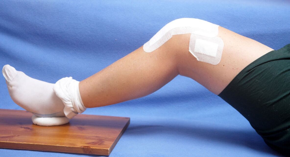 Une blessure au genou comme cause d'arthrose